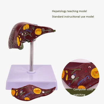 Патологическая модель печени Жировое Склеротическое заболевание печени, преобразованное в анатомическую модель печени человека